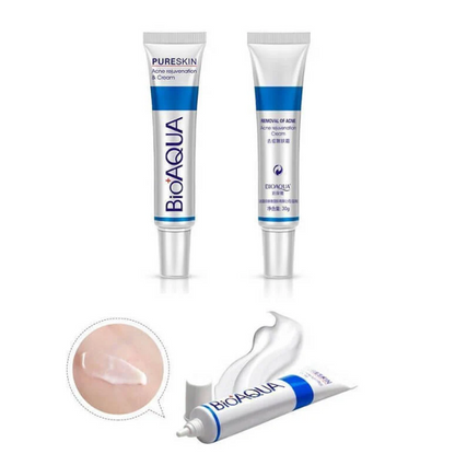 BIOAQUA Acne Scar Removal Rejuvenation Cream